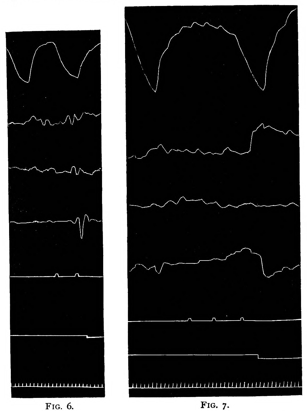 Two tall black panels of white tracings, one narrow and one wide, each with a large breathing wave at the top, three thin jittering lines of head movement below it, a flat line with small blips for the taps, a stepped line for the response, and a row of tick marks for fifth-seconds along the foot, captioned Fig. 6 and Fig. 7