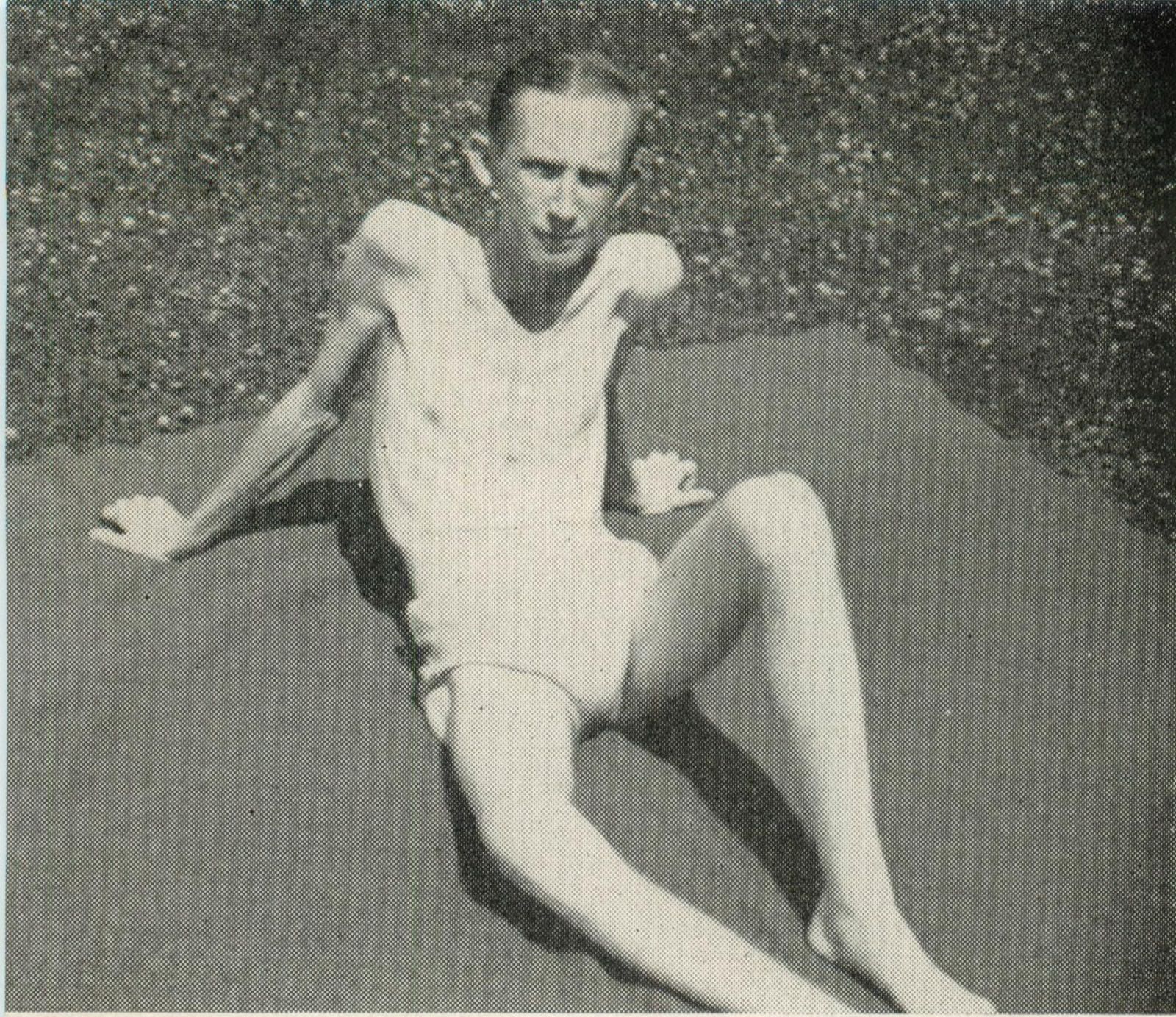 A thin young man in white shorts and vest sits on a mat on the grass in sunlight, propped on one arm, the bones of his shoulders and knees showing